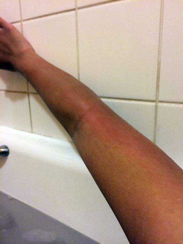 Niah-Selway-who-is-allergic-to-water2