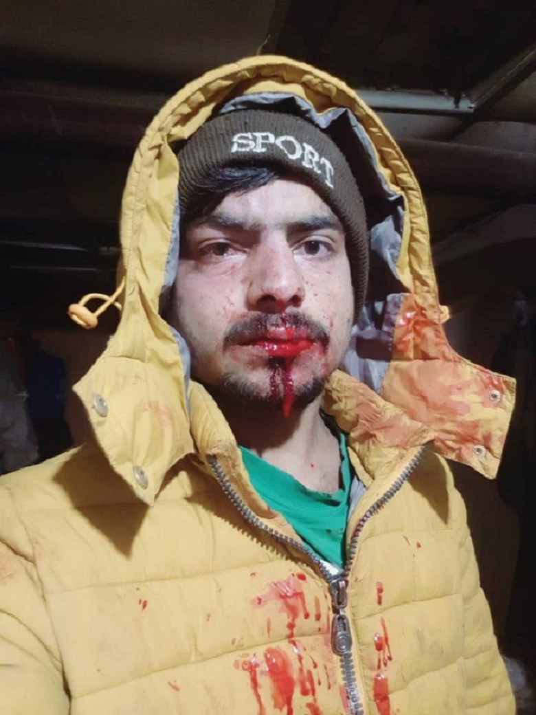 κξηκ