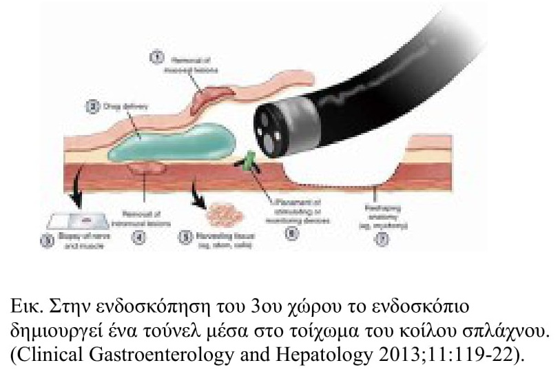 Εντυπωσιακές εξελίξεις στην Ενδοσκοπική Γαστρεντερολογία